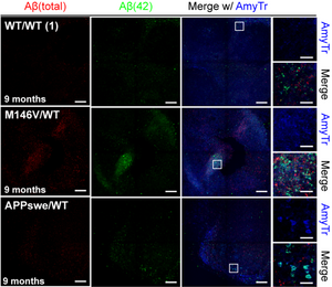Amytracker visualizes Aβ aggregates in Alzheimer’s organoid models