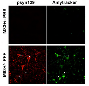 Amytracker is used to shed light on Protein Aggregation in Parkinson’s Disorder