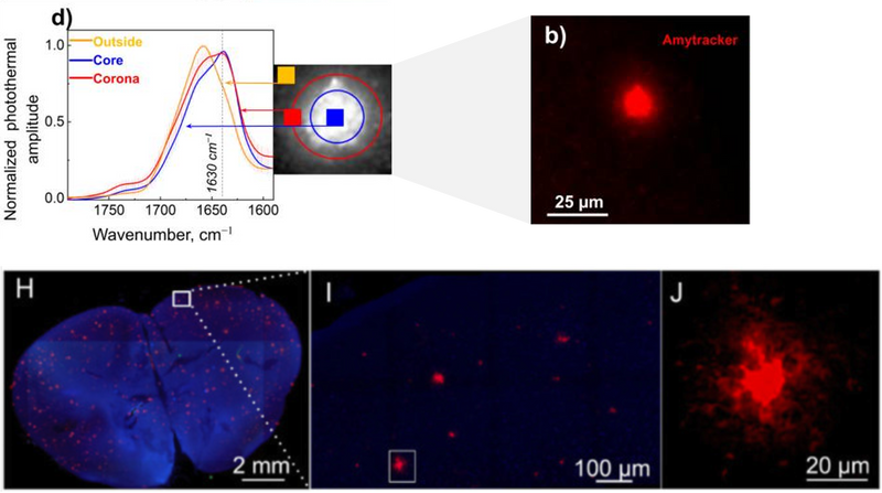 FL-OPTIR for studying biophysical properties of amyloids in cells and tissues