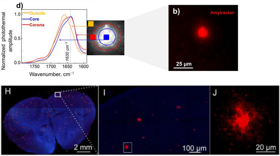 FL-OPTIR for studying biophysical properties of amyloids in cells and tissues