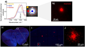 FL-OPTIR for studying biophysical properties of amyloids in cells and tissues