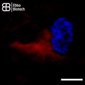 Amytracker for studying α-synuclein aggregates