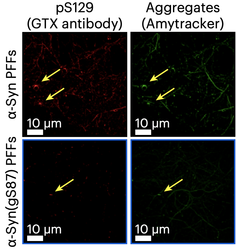 Glycosylation guides a safer strain of α-synuclein – Ebba Biotech AB
