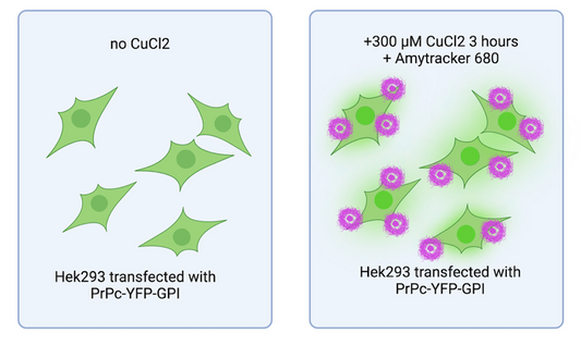 Copper’s role in prion protein misbehaviour
