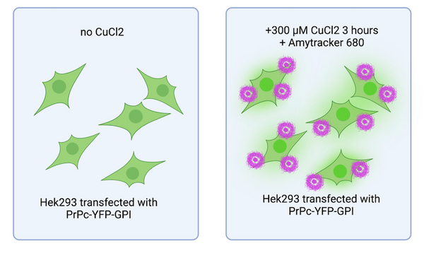 Copper’s role in prion protein misbehaviour – Ebba Biotech AB