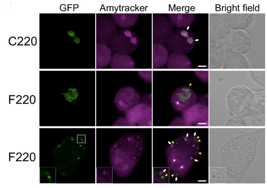 The structural basis of TDP-43 aggregation