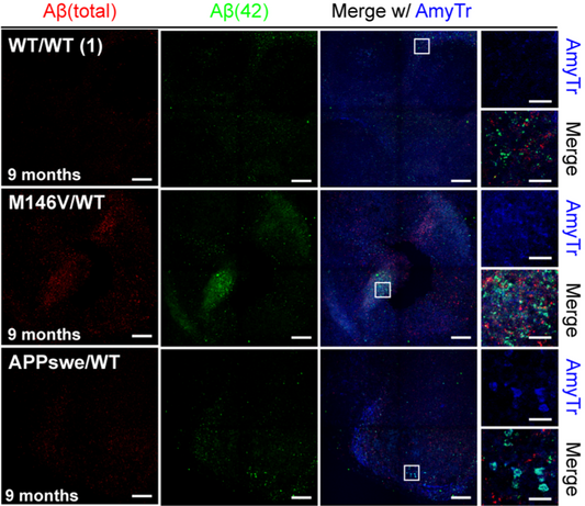 Amytracker visualizes Aβ aggregates in Alzheimer’s organoid models
