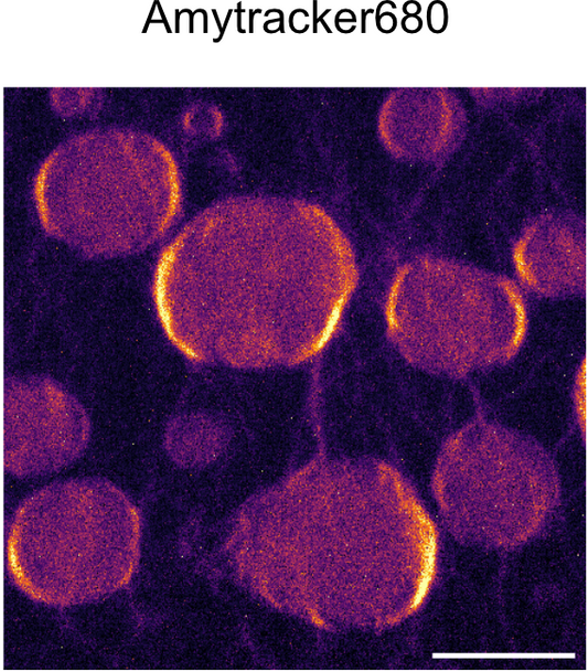 Transition to aggregation in hnRNPA1A condensates visualised using Amytracker