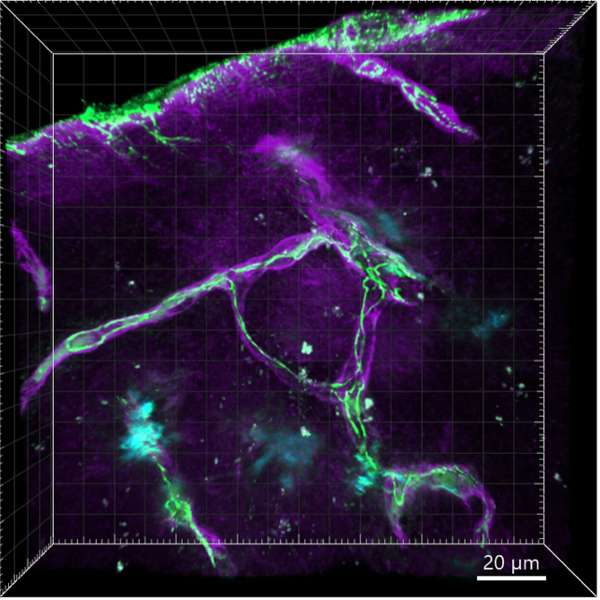 Testimonial - Linh Tran