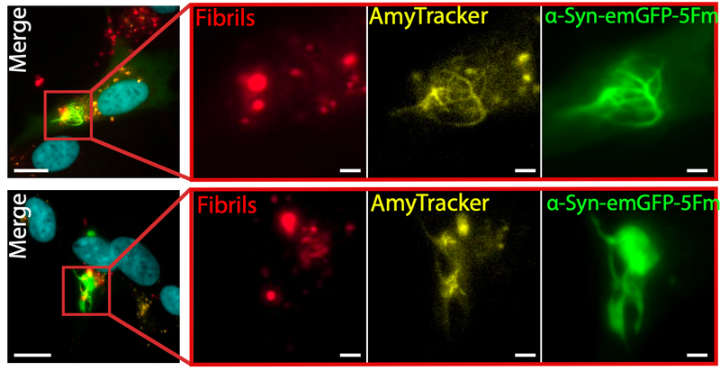 Phase separated α-synuclein is more prone to aggregation