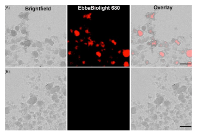 Exciting breakthrough in understanding UPEC Infection using EbbaBiolight!
