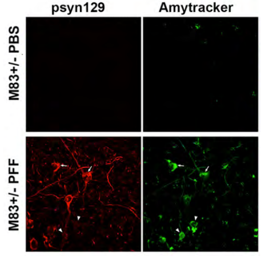 Amytracker is used to shed light on Protein Aggregation in Parkinson’s Disorder