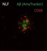 Spatial pattern of microglial activation in relation to amyloid plaques