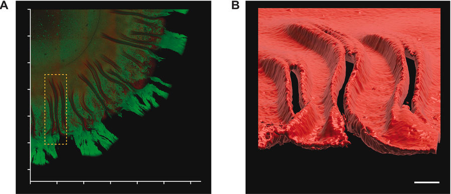 Real-time insights into curli and cellulose dynamics in UPEC
