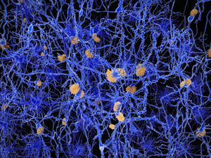 In vivo amyloid staining and intravital imaging