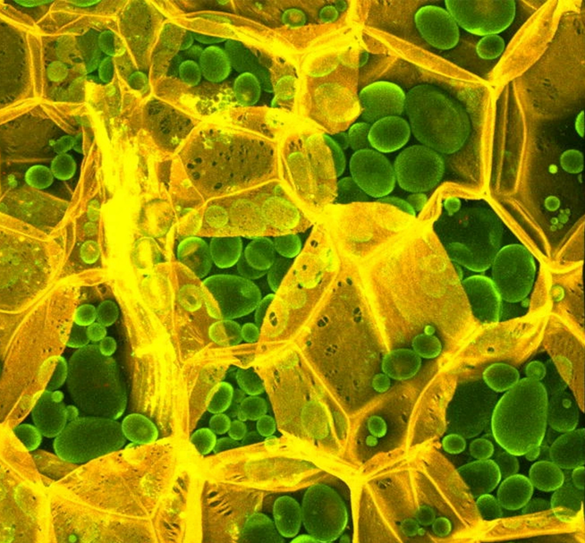 Cellulose (yellow) and starch granules (green) in fresh potato stained by Carbotrace 680. The optotracer generates unique optical fingerprints upon binding to different glucans, allowing cellulose and starch to be distinguished in a single image. Image courtesy of Ferdinand X. Choong (AIMES, Karolinska Institutet).