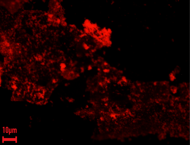 EDIC microscopy and fluorescence microscopy showing EbbaBiolight 680 staining of biofilm-associated extracellular matrix on silicone catheter surfaces after microbial growth. Images adapted from Romero et al., PLOS ONE (2025), CC BY 4.0.