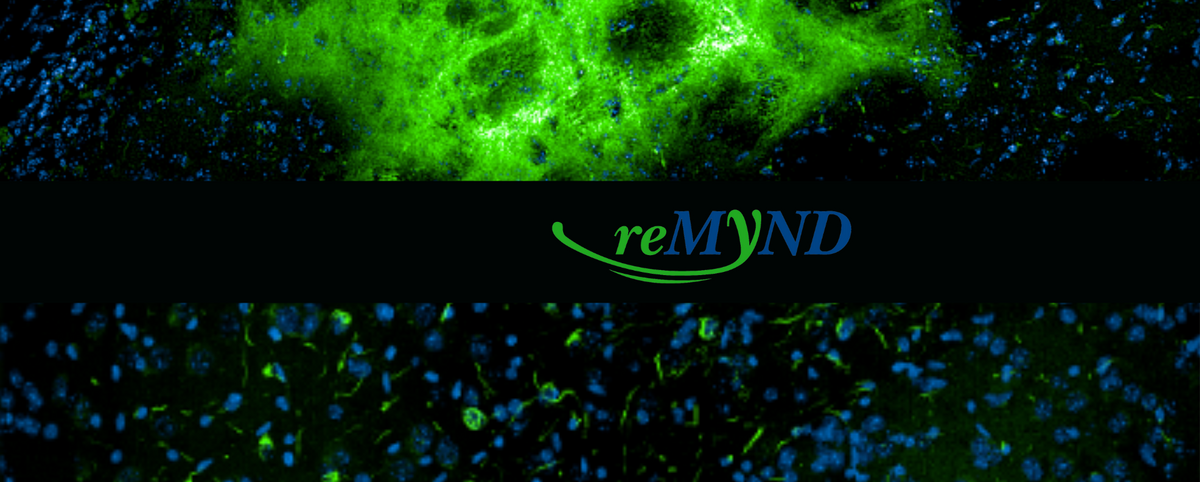 Seeding models using α-synuclein PFFs injected 9-weeks into the dorsal striatum  before staining α-synuclein pathology with Amytracker 520 (green) located in the dorsal striatum (top) and spreading into the amygdala (bottom). Image courtesy of Dr. Tom Cornelissen, Science Director Contract Research, reMYND (InnoSer).